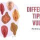 differenti tipi di vulve, anatomia vulva